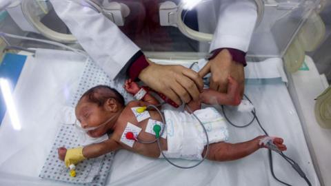 A Palestinian medic treats a premature baby lying inside an incubator at the  Patient's Friends Benevolent Society hospital in Gaza City (25 February 2025)