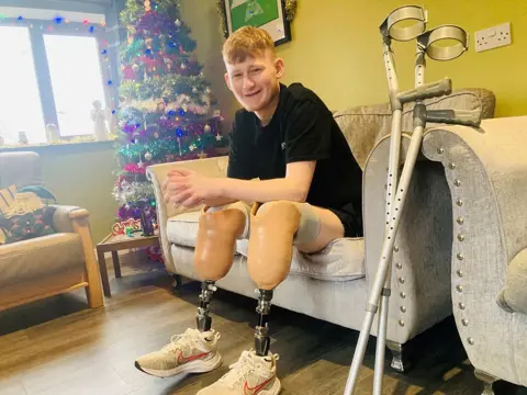 Teenage boy smiling at camera, sitting on grey sofa, with two prosthetic legs below his knee, pair of crutches resting next to him, decorated Christmas tree in the corner.