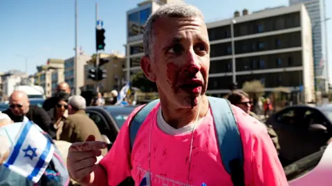 BBC Anti-government protester Shay Noter, who suffered a broken nose and bloodied face, after being attacked by a driver near the British embassy in Tel Aviv, Israel (16 March 2023)