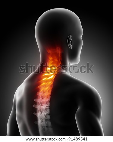 Pain in cervical spine anatomy