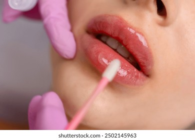 Injection procedure for lip augmentation, close-up. The cosmetologist slowly and carefully injects filler into the client lips. Advertising concept for facial care, youth and beauty