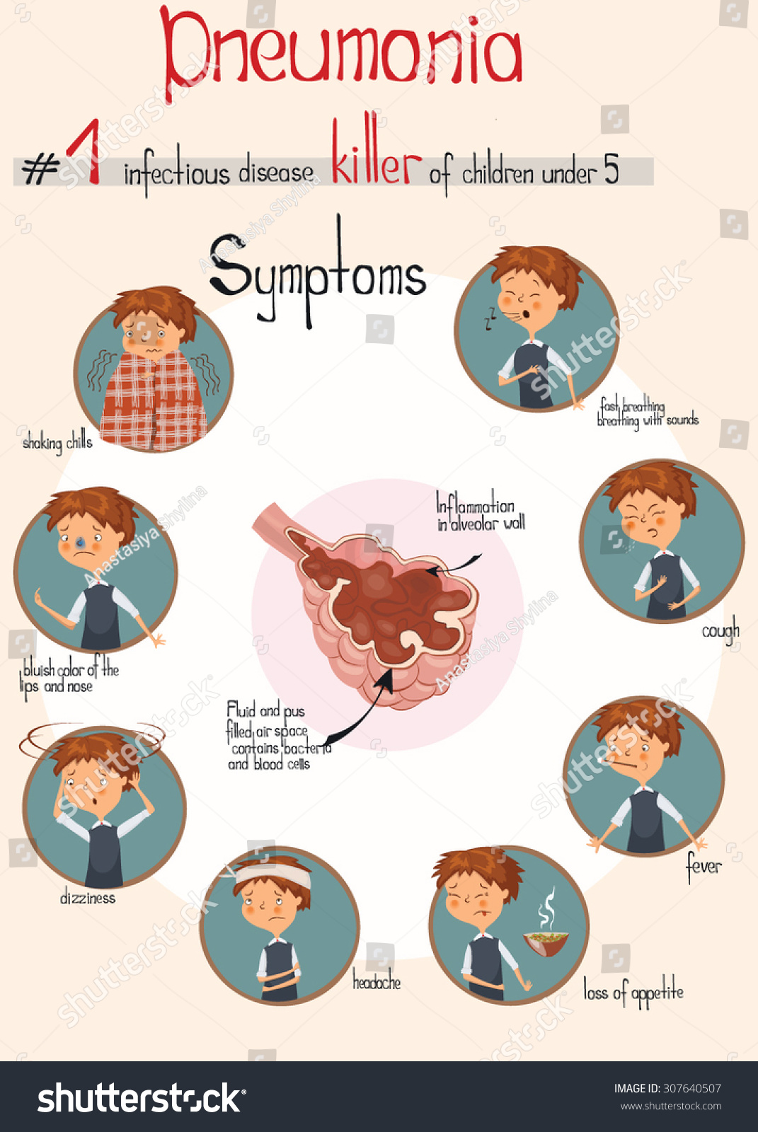 Pneumonia Infographic