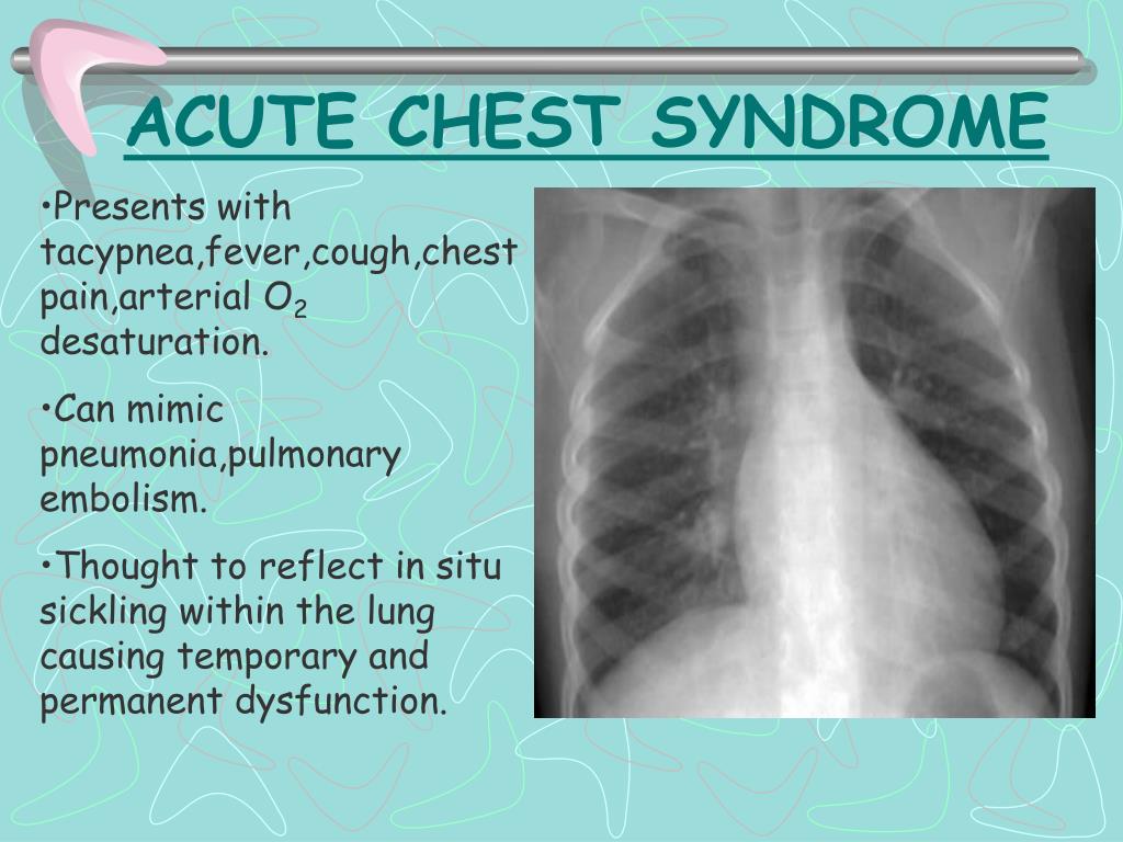 PPT - HEMOGLOBINOPATHIES PowerPoint Presentation, free download - ID ...