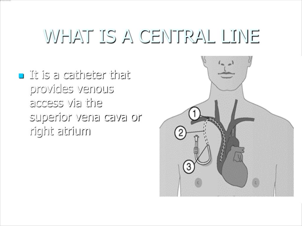 PPT - CENTRAL LINES AND ARTERIAL LINES PowerPoint Presentation, free ...