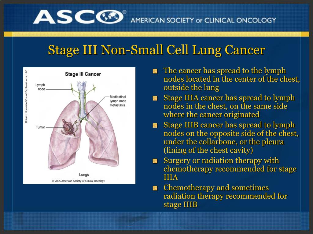 lung cancer that has spread life expectancy Lung cancer spread to spine ...