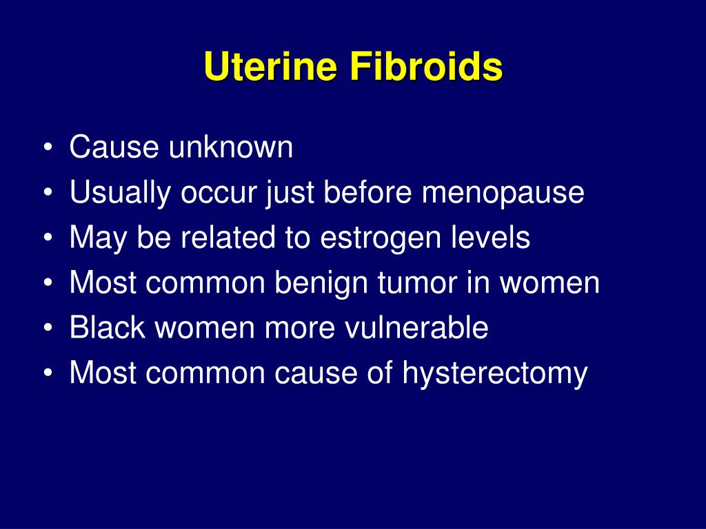 PPT - Uterine Fibroid Embolization PowerPoint Presentation, free ...