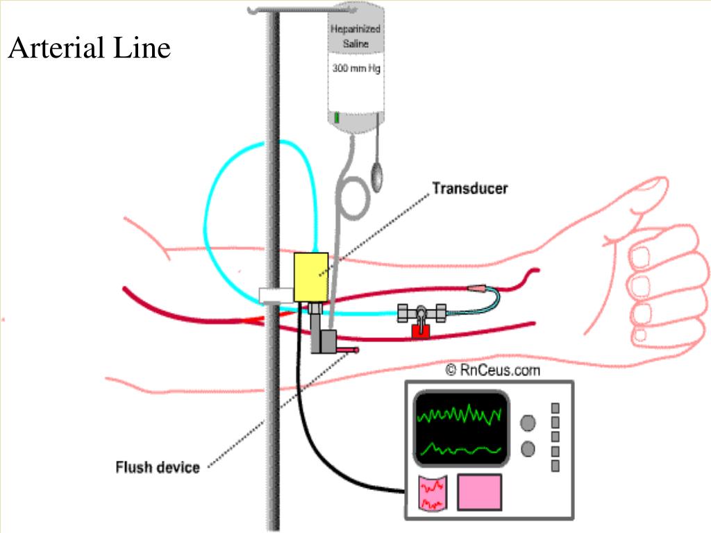 PPT - Hemodynamic Monitoring PowerPoint Presentation - ID:434068