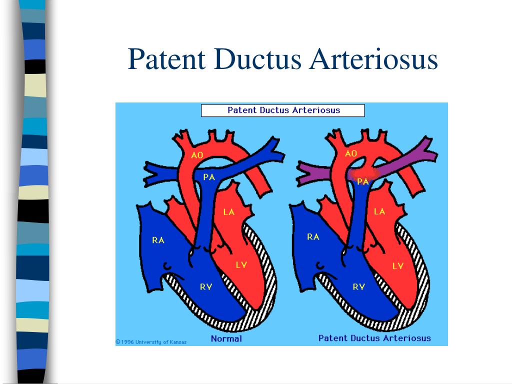 PPT - The Preterm Neonate Phm 456 Michael Heffer BSc.Phm.MHSc ...