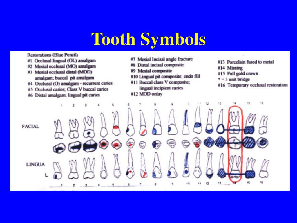 Dental Charting Symbols Chart