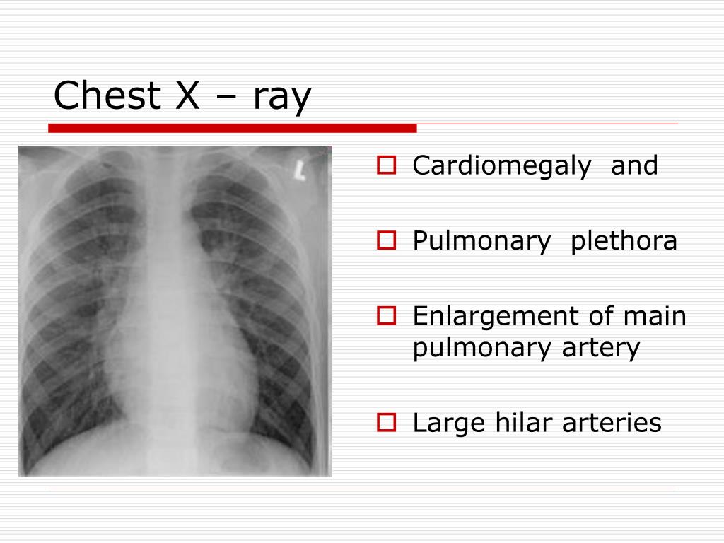 PPT - Congenital heart disease (CHD) PowerPoint Presentation, free ...