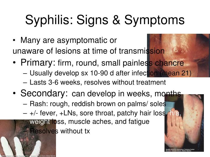 Syphilis Signs And Symptoms