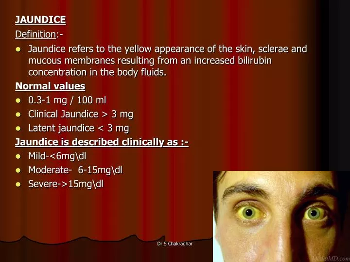 PPT - JAUNDICE Definition :- PowerPoint Presentation, free download ...