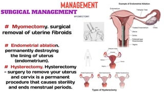 Menorrhagia and metorrhagia | PPT