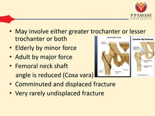 • May involve either greater trochanter or lesser
trochanter or both
• Elderly by minor force
• Adult by major force
• Femoral neck shaft
angle is reduced (Coxa vara)
• Comminuted and displaced fracture
• Very rarely undisplaced fracture
 