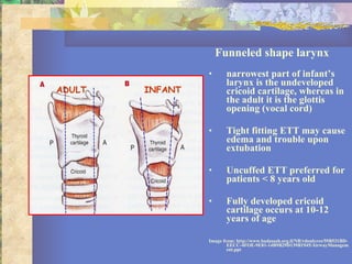 Funneled shape larynx narrowest part of infant’s larynx is the undeveloped cricoid cartilage, whereas in the adult it is the glottis opening (vocal cord) Tight fitting ETT may cause edema and trouble upon extubation Uncuffed ETT preferred for patients < 8 years old Fully developed cricoid cartilage occurs at 10-12 years of age Image from: http://www.hadassah.org.il/NR/rdonlyres/59B531BD-EECC-4FOE-9E81-14B9B29D139B1945/AirwayManagement.ppt INFANT ADULT 