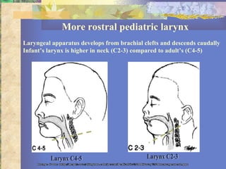 More rostral pediatric larynx Laryngeal apparatus develops from brachial clefts and descends caudally Infant’s larynx is higher in neck (C2-3) compared to adult’s (C4-5) Larynx C4-5 Larynx C2-3 Image from: http://depts.washington.edu/pccm/Pediatric%20Airway%20management.ppt 