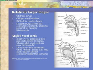 Relatively larger tongue Obstructs airway Obligate nasal breathers Difficult to visualize larynx Straight laryngoscope blade completely elevates the epiglottis, preferred for pediatric laryngoscopy Angled vocal cords Infant’s vocal cords have more angled attachment to trachea, whereas adult vocal cords are more perpendicular Difficulty in nasal intubations where “blindly” placed  ETT may easily lodge in anterior commissure rather than in trachea Image from: http://www.utmb.edu/otoref/Grnds/Pedi-airway-2001-01/Pedi-airway-2001-01-slides.pdf 