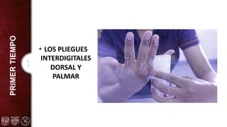 2
2
PRIMER
TIEMPO
• LOS PLIEGUES
INTERDIGITALES
DORSAL Y
PALMAR
 