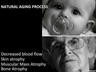 Proceso Natural de
Envejecimiento

Atrofia Ósea
Disminución del Flujo Sanguíneo
La Atrofia de Piel
Atrofia de la Masa Muscular

 