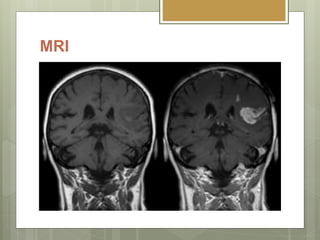 MRI
 T1 & T2 Relaxation times.
 