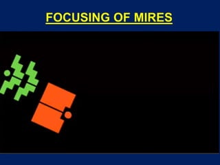 FOCUSING OF MIRES
 