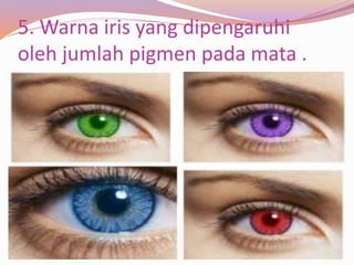 5. Warna iris yang dipengaruhi
oleh jumlah pigmen pada mata .
 