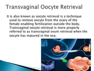 It is also known as oocyte retrieval is a technique
used to remove oocyte from the ovary of the
female enabling fertilization outside the body.
Transvaginal oocyte retrieval is more properly
referred to as transvaginal ovum retrieval when the
oocyte has matured in the ova.
 