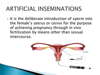  It is the deliberate introduction of sperm into
the female’s uterus or cervix for the purpose
of achieving pregnancy through in vivo
fertilization by means other than sexual
intercourse.
 