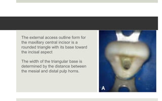 The external access outline form for
the maxillary central incisor is a
rounded triangle with its base toward
the incisal aspect
The width of the triangular base is
determined by the distance between
the mesial and distal pulp horns.
 