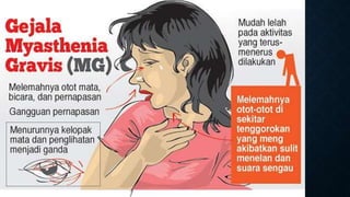 Acute flaccid paralysis gk