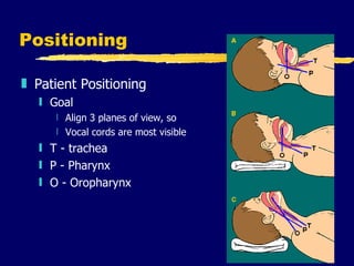 Positioning Patient Positioning Goal Align 3 planes of view, so  Vocal cords are most visible T - trachea P - Pharynx O - Oropharynx 