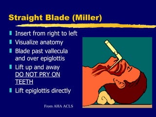 Straight Blade (Miller) Insert from right to left Visualize anatomy Blade past vallecula and over epiglottis Lift up and away  DO NOT PRY ON TEETH   Lift epiglottis directly From AHA ACLS 