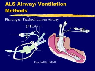 ALS Airway/ Ventilation Methods Pharyngeal Tracheal Lumen Airway (PTLA)  From AMLS, NAEMT 