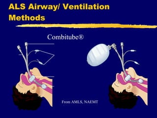 ALS Airway/ Ventilation Methods Combitube® From AMLS, NAEMT 