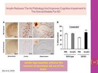 Amylin ReducesTheAd PathologyAnd Improves Cognitive Impairment In
TheAnimal Models ForAD
amylin type peptides enhance the
removal of neurotoxic Aβ out of the
brain.
23
(Qui et al, 2014)
 