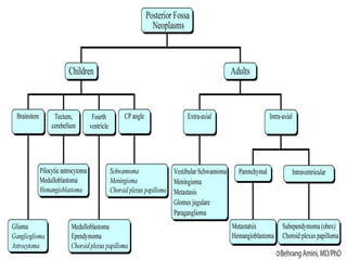 Anaesthesia for posterior fossa surgery