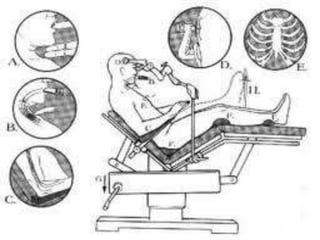 Anaesthesia for posterior fossa surgery