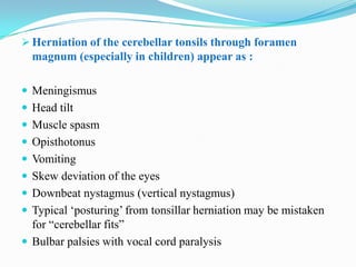  Herniation of the cerebellar tonsils through foramen
  magnum (especially in children) appear as :

 Meningismus
 Head tilt
 Muscle spasm
 Opisthotonus
 Vomiting
 Skew deviation of the eyes
 Downbeat nystagmus (vertical nystagmus)
 Typical „posturing‟ from tonsillar herniation may be mistaken
  for “cerebellar fits”
 Bulbar palsies with vocal cord paralysis
 