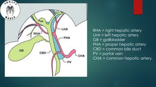 RHA = right hepatic artery
LHA = left hepatic artery
GB = gallbladder
PHA = proper hepatic artery
CBD = common bile duct
PV = portal vein
CHA = common hepatic artery.
 