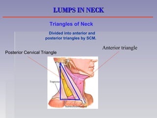 Sternocleidomastoid
Trapezius
Anterior triangle
LUMPS IN NECKLUMPS IN NECK
Triangles of Neck
Divided into anterior and
posterior triangles by SCM.
Posterior Cervical Triangle
 