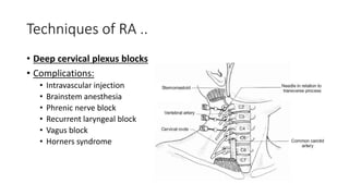 Techniques of RA ..
• Deep cervical plexus blocks
• Complications:
• Intravascular injection
• Brainstem anesthesia
• Phrenic nerve block
• Recurrent laryngeal block
• Vagus block
• Horners syndrome
 