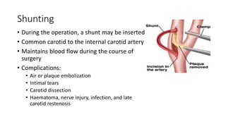 Shunting
• During the operation, a shunt may be inserted
• Common carotid to the internal carotid artery
• Maintains blood flow during the course of
surgery
• Complications:
• Air or plaque embolization
• Intimal tears
• Carotid dissection
• Haematoma, nerve injury, infection, and late
carotid restenosis
 