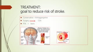 TREATMENT:
goal to reduce risk of stroke.
 Conservative – Antiaggregative
 Surgery CEA
 PTA + Stent
 