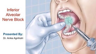 Inferior
Alveolar
Nerve Block
Presented By:
Dr. Anika Agnihotri
 