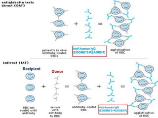 Recipient
Donor
Anti-human IgG
(COOMB’S REAGENT)
Anti-human IgG
(COOMB’S REAGENT)
 