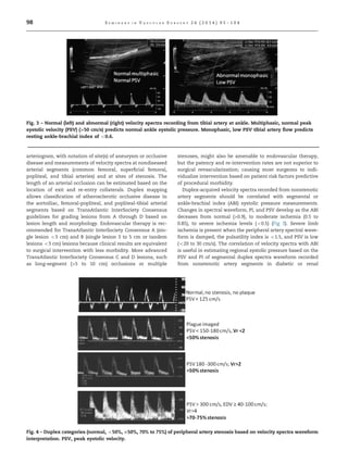 Arterial duplex images and interp | PDF