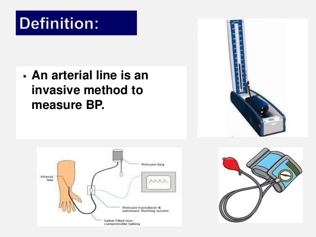 Arterial lines by Dr.Tinku Joseph