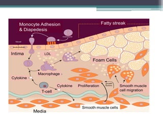 Atherosclerosis