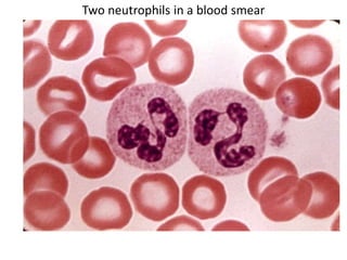 Two neutrophils in a blood smear
 