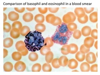 Comparison of basophil and eosinophil in a blood smear
 